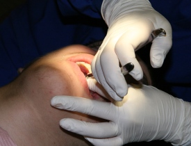 הנזקים השכיחים במסגרת טיפולי שיניים ואשר הופכים במקרים רבים לתביעות בגין רשלנות רפואית
