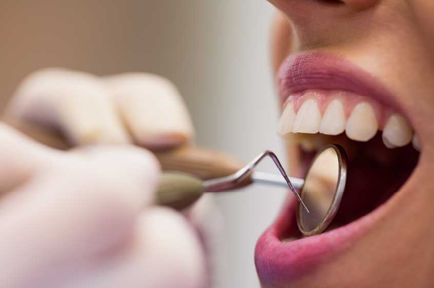 הנזקים השכיחים במסגרת טיפולי שיניים ואשר הופכים במקרים רבים לתביעות בגין רשלנות רפואית