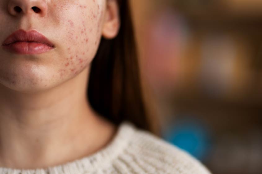 תביעה בעקבות טיפול רשלני בפצעי בגרות